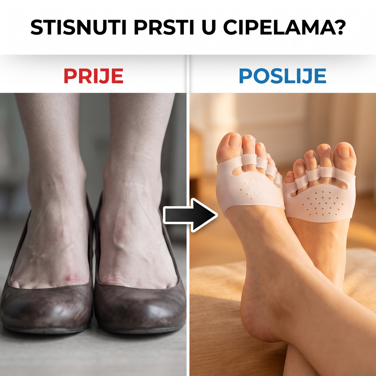 Alignura™ 3-in-1 silikonski razdjelnik prstiju za stopalo (1+1 GRATIS) Kvalitetno